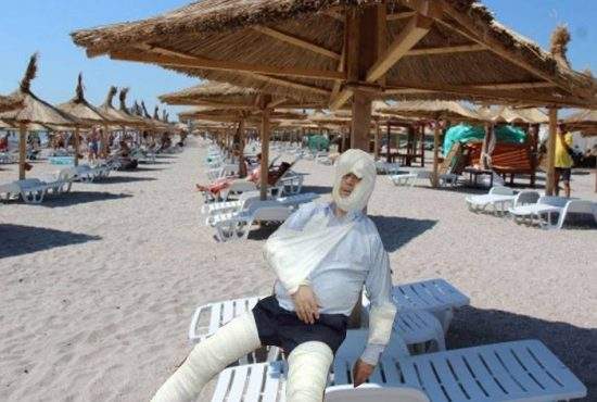 Te duci la Mamaia? Nu uita crema anti-bodyguarzi, care îţi acoperă vânătăile