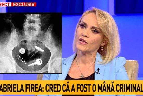 10 posibile explicaţii pentru sârma lui Firea