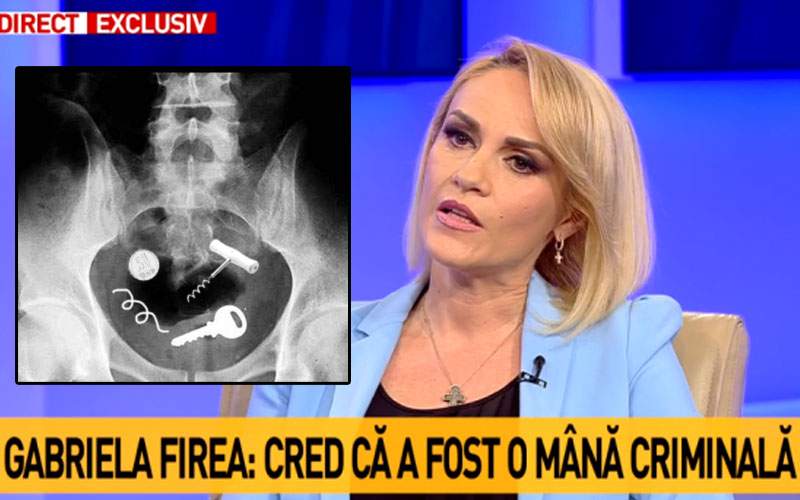 10 posibile explicaţii pentru sârma lui Firea