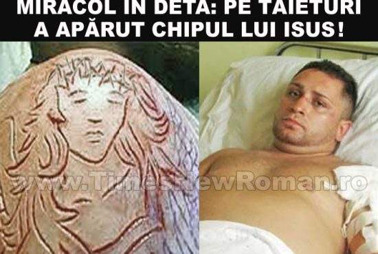 Tăieturile bărbatului agresat din Deta au luat forma chipului lui Isus