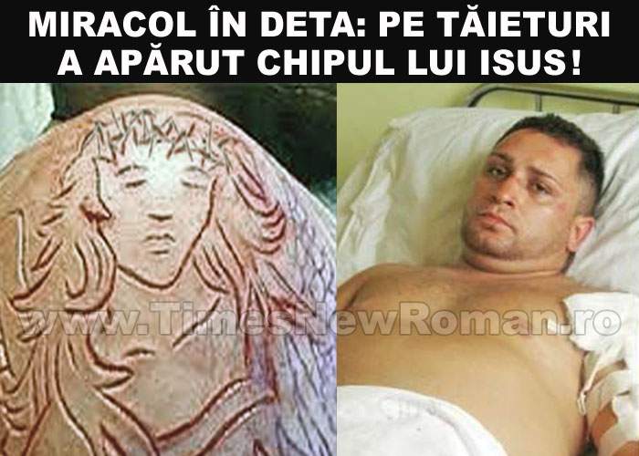 Tăieturile bărbatului agresat din Deta au luat forma chipului lui Isus