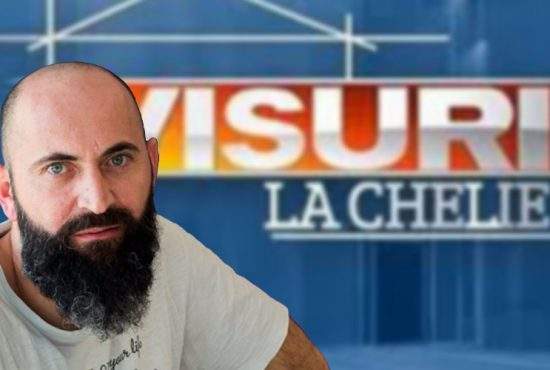 Pro TV lansează emisiunea “Visuri la chelie”, în care nişte amărâţi primesc implant de păr