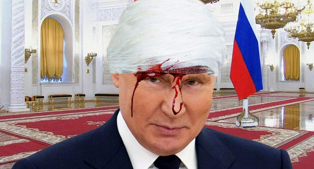 Ca-n Benny Hill! Putin a ajuns în spital după ce s-a dat cap în cap în cap cu sosia
