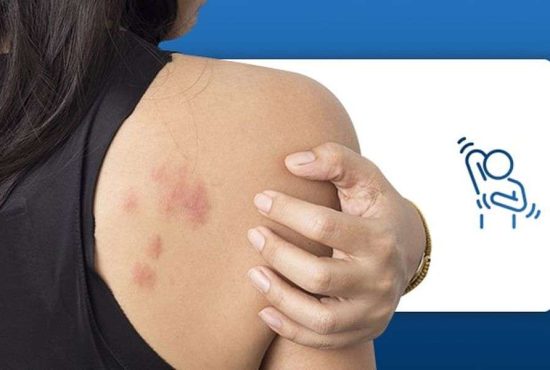 7 alergii periculoase de care nimeni nu vorbește