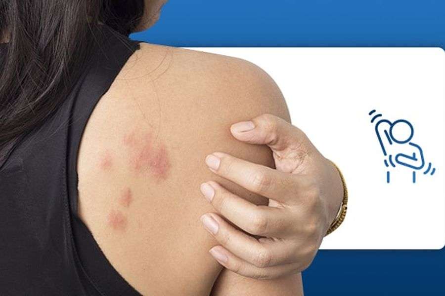 7 alergii periculoase de care nimeni nu vorbește