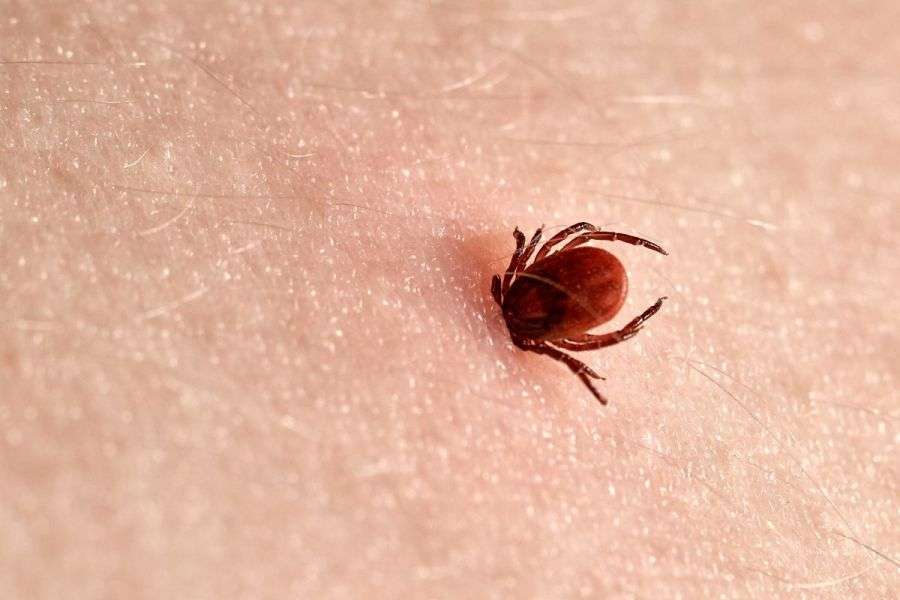 7 metode simple de scos căpușele