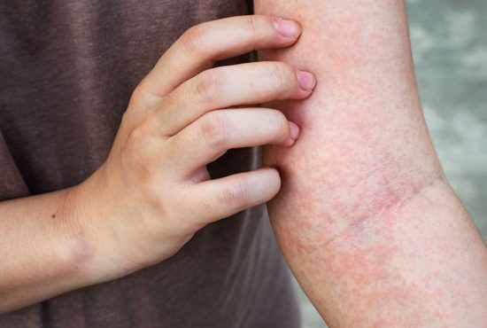 Ce înseamnă cele mai frecvente 7 tipuri de mâncărimi