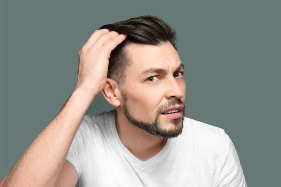 7 indicii că urmează să chelești