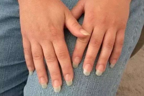 7 indicii că e timpul să-ți tai unghiile de la mâini
