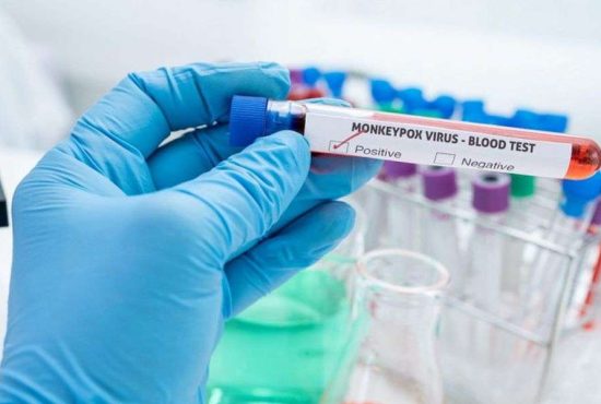 7 lucruri pe care trebuie să le facă bărbații care au variola maimuței