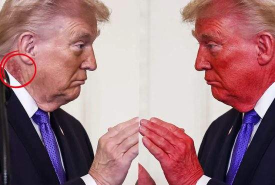 Problemă rezolvată! Trump s-a colorat în roșu și acum nu i se mai vede pata de pe gât