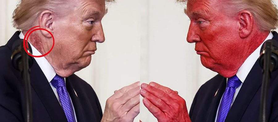 Problemă rezolvată! Trump s-a colorat în roșu și acum nu i se mai vede pata de pe gât