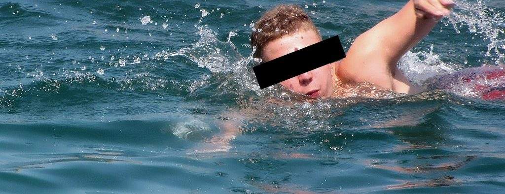 Încă un turist muşcat de peştele-iepure după ce i-a ieşit morcovul din slip